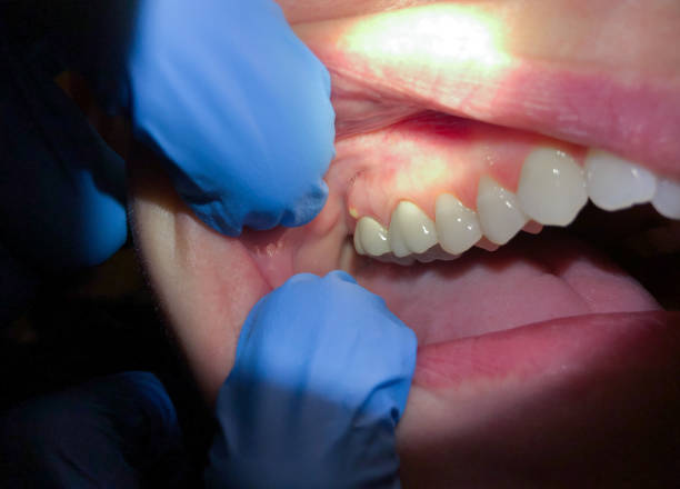 Best Emergency Dentist Near Me  in Harleigh, PA