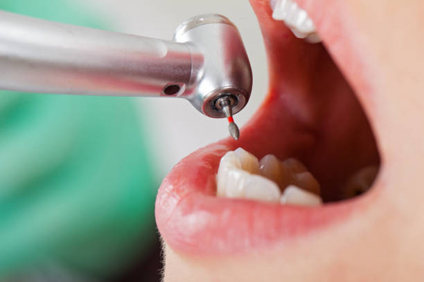 Best Emergency Tooth Extraction  in Harleigh, PA